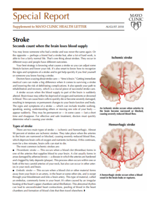 cover image of Mayo Clinic Special Report. Stroke